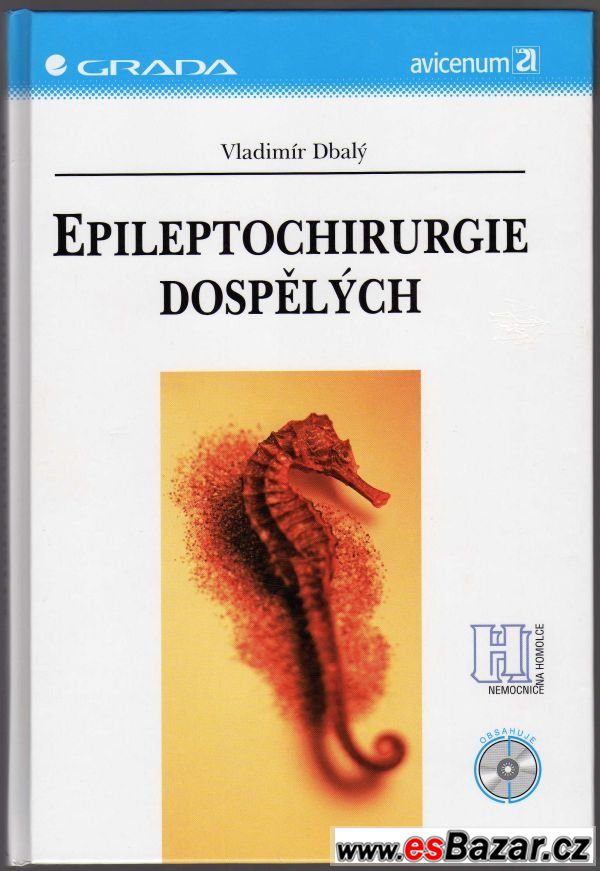 EPILEPTOCHIRURGIE DOSPĚLÝCH – fotografie 1