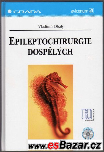 EPILEPTOCHIRURGIE DOSPĚLÝCH – fotografie 1