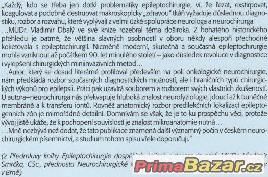 EPILEPTOCHIRURGIE DOSPĚLÝCH – fotografie 3