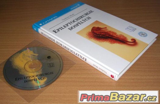 EPILEPTOCHIRURGIE DOSPĚLÝCH – fotografie 4