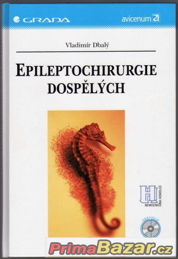 EPILEPTOCHIRURGIE DOSPĚLÝCH – fotografie 1